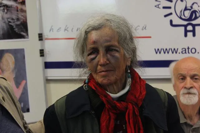 Demokratik ve Barışçıl Yöntemlerle Hakkını Arayanlara Yönelik Polis Şiddeti Kabul Edilemez!